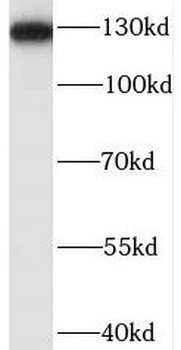 BUB1B Rabbit Polyclonal Antibody