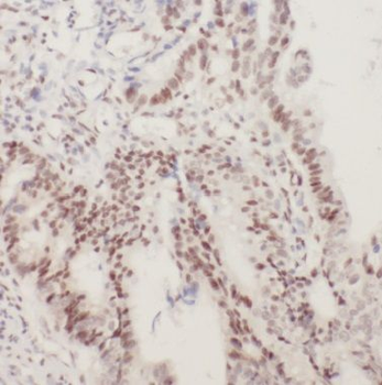BUB1B Rabbit Polyclonal Antibody