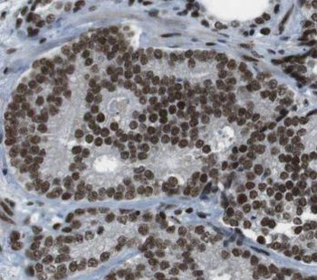 C1D Rabbit Polyclonal Antibody