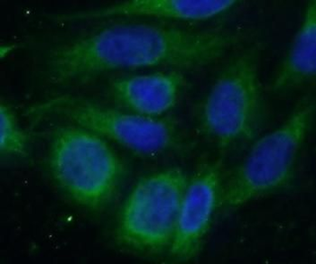METTL18 Rabbit Polyclonal Antibody
