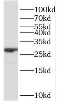 CHTOP Rabbit Polyclonal Antibody