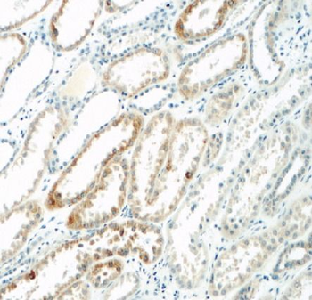 C1QTNF3 Rabbit Polyclonal Antibody