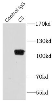 C3/C3b/C3c Rabbit Polyclonal Antibody