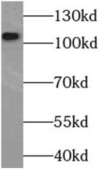 C3/C3b/C3c Rabbit Polyclonal Antibody