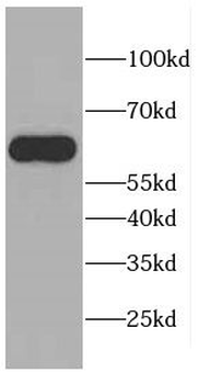 CEP57L1 Rabbit Polyclonal Antibody