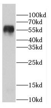 TTI2 Rabbit Polyclonal Antibody