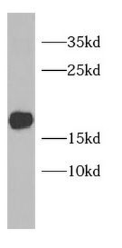 PLGRKT Rabbit Polyclonal Antibody