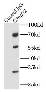 C9orf72 Rabbit Polyclonal Antibody
