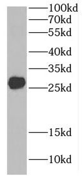 C9orf72 Rabbit Polyclonal Antibody