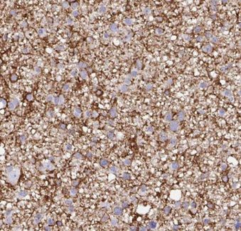C9orf72 Rabbit Polyclonal Antibody