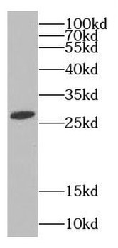 C9orf72 Rabbit Polyclonal Antibody