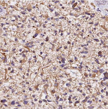 C9orf72 Rabbit Polyclonal Antibody