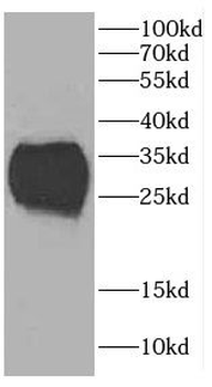 CA5B Rabbit Polyclonal Antibody