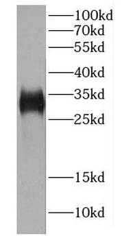 CA8 Rabbit Polyclonal Antibody
