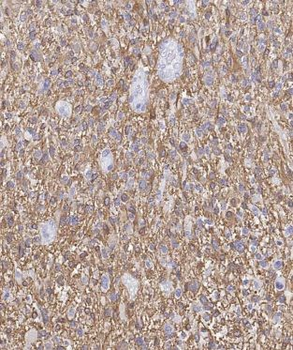 CA8 Rabbit Polyclonal Antibody