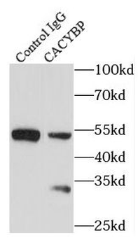 CACYBP Rabbit Polyclonal Antibody