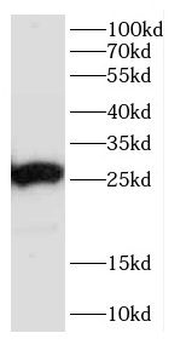 CACYBP Rabbit Polyclonal Antibody