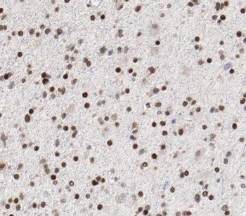 CACYBP Rabbit Polyclonal Antibody