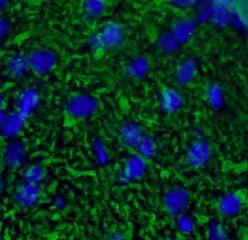 CALB1 Rabbit Polyclonal Antibody
