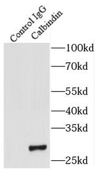 CALB1 Rabbit Polyclonal Antibody