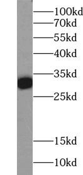 CALB1 Rabbit Polyclonal Antibody
