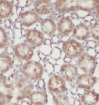 CALB1 Rabbit Polyclonal Antibody