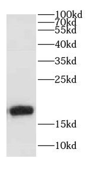 CALM3 Rabbit Polyclonal Antibody
