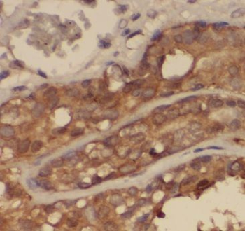 CALM3 Rabbit Polyclonal Antibody