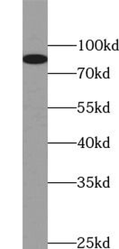 CANX Rabbit Polyclonal Antibody