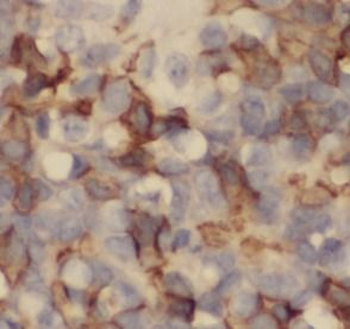 CANX Rabbit Polyclonal Antibody