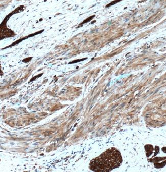 CAPN1 Rabbit Polyclonal Antibody