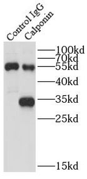 CNN1 Rabbit Polyclonal Antibody