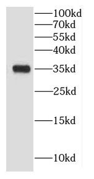 CNN1 Rabbit Polyclonal Antibody