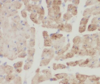 CNN1 Rabbit Polyclonal Antibody