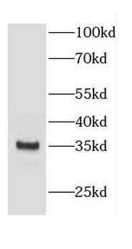 CNN1 Rabbit Polyclonal Antibody