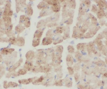 CNN1 Rabbit Polyclonal Antibody