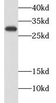 CALB2 Rabbit Polyclonal Antibody