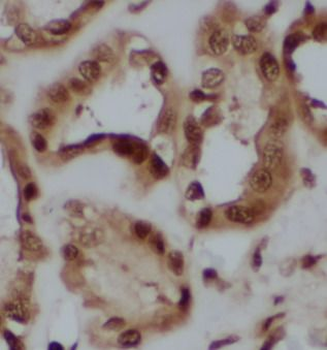 CALB2 Rabbit Polyclonal Antibody