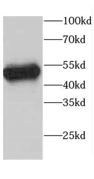 CAP2 Rabbit Polyclonal Antibody