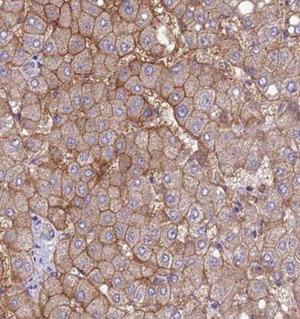 CAP2 Rabbit Polyclonal Antibody