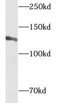 CAPRIN2 Rabbit Polyclonal Antibody