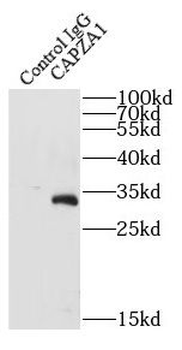 CAPZA1 Rabbit Polyclonal Antibody