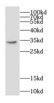 CAPZA1 Rabbit Polyclonal Antibody
