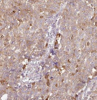 CAPZA1 Rabbit Polyclonal Antibody