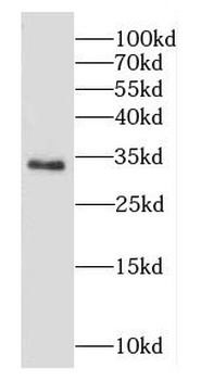 CAPZA1 Rabbit Polyclonal Antibody