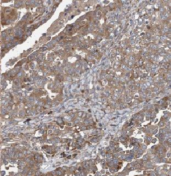 CAPZA1 Rabbit Polyclonal Antibody