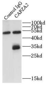 CAPZA2 Rabbit Polyclonal Antibody
