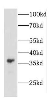 CAPZA2 Rabbit Polyclonal Antibody