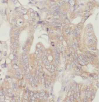 CAPZA2 Rabbit Polyclonal Antibody