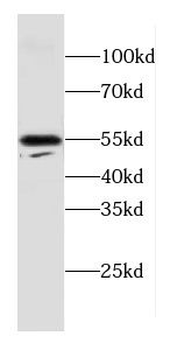 CPE Rabbit Polyclonal Antibody